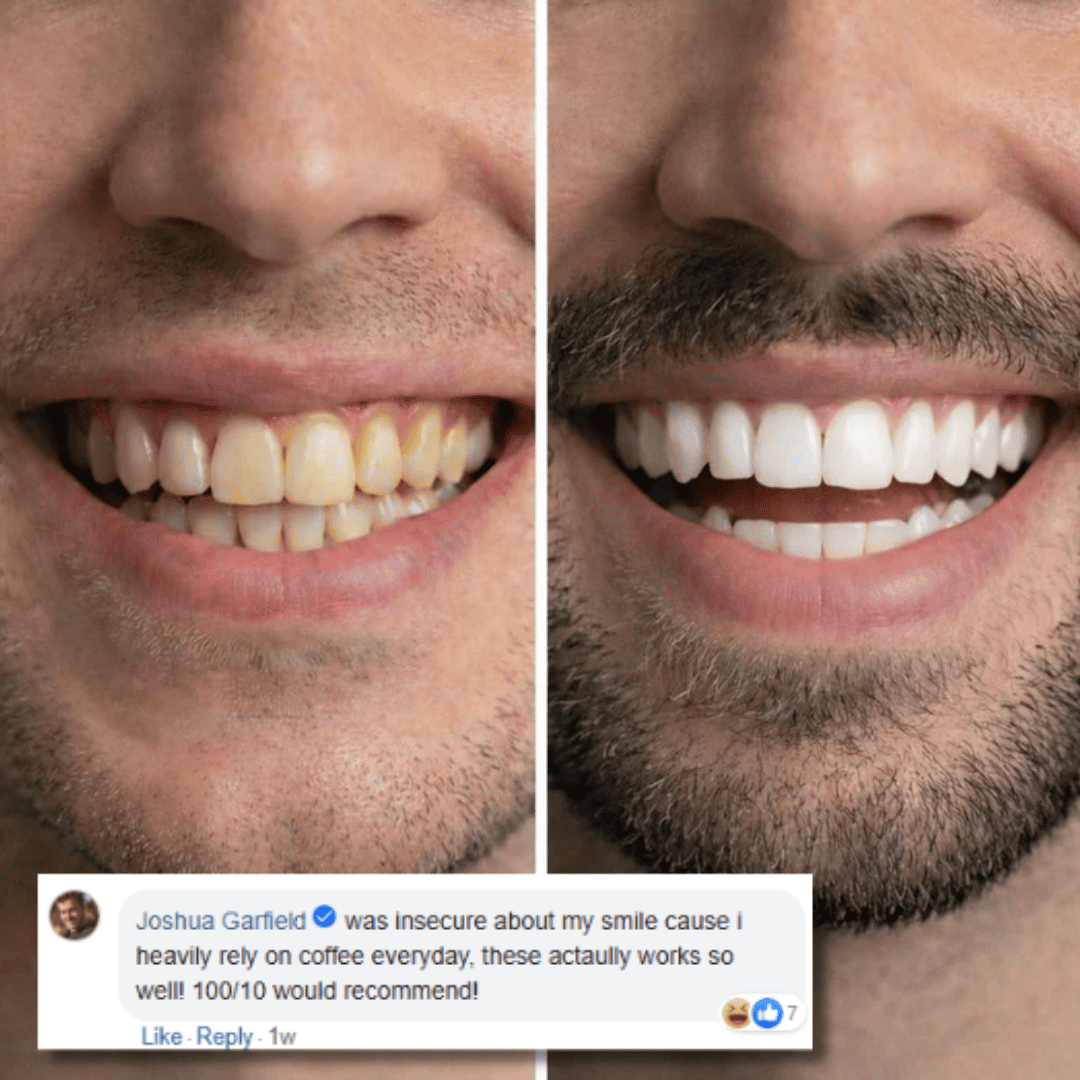 Color Correcting Whitening Strips