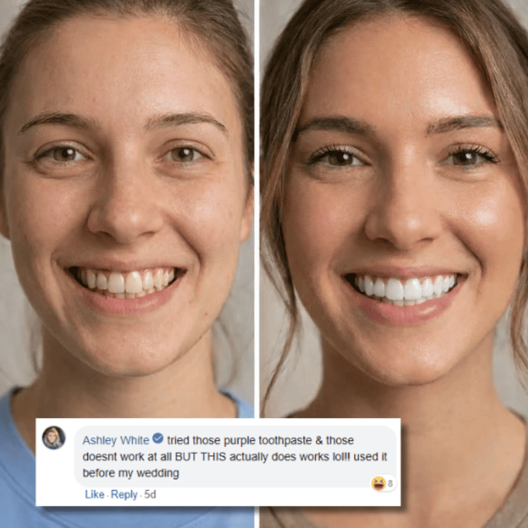 Color Correcting Whitening Strips